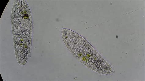  Vibrant Vorticella! An Intricate Single-celled Predator With Tentacles That Sweep Prey Into Its Mouth