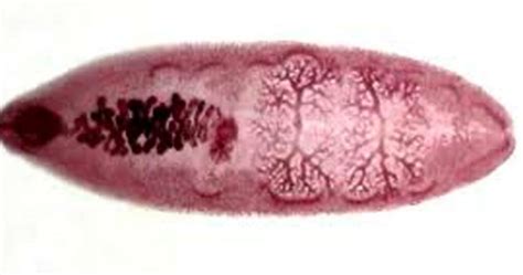  Giant Intestinal Fluke! A Parasite That Makes Its Home Inside Your Guts