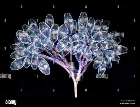  Vibrant Vorticella! An Intricate Single-celled Predator With Tentacles That Sweep Prey Into Its Mouth